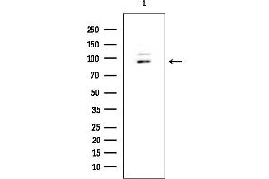 Western blot analysis of lysates from HUVEC cells, using CDH18 Mouse Monoclonal Antibody at 1/1000 dilution.