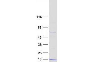Validation with Western Blot