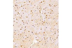 anti-Wolf-Hirschhorn Syndrome Candidate 1-Like 1 (WHSC1L1) antibody