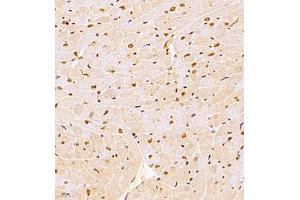 Immunohistochemistry of paraffin embedded rat heart using NSD3 (ABIN7076233) at dilution of 1:1400 (400x lens) (WHSC1L1 anticorps)