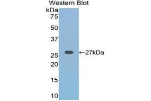 Western Blotting (WB) image for anti-Frizzled Family Receptor 1 (Fzd1) (AA 117-322) antibody (ABIN3204002) (FZD1 anticorps  (AA 117-322))