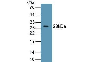 Detection of Recombinant RIPK3, Human using Polyclonal Antibody to Receptor Interacting Serine Threonine Kinase 3 (RIPK3) (RIPK3 anticorps  (AA 1-217))