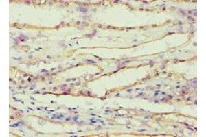 Immunohistochemistry of paraffin-embedded human kidney tissue using ABIN7143685 at dilution of 1:100