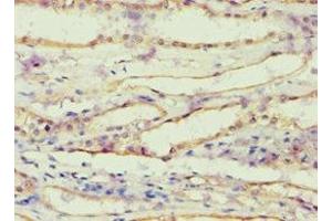 Immunohistochemistry of paraffin-embedded human kidney tissue using ABIN7143685 at dilution of 1:100 (AKR1B1 anticorps  (AA 1-316))