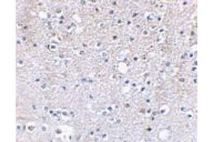 Immunohistochemical staining of human brain tissue using AP30386PU-N Grik5 antibody at 2. (GRIK5 anticorps  (C-Term))