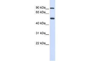 WB Suggested Anti-LOXL1 Antibody Titration: 0. (LOXL1 anticorps  (Middle Region))
