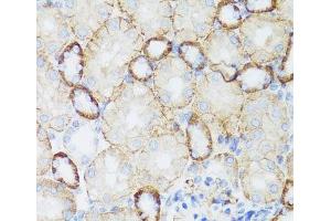 Immunohistochemistry of paraffin-embedded Mouse kidney using NEFH Polyclonal Antibody at dilution of 1:100 (40x lens). (NEFH anticorps)