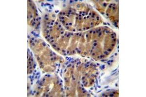 Immunohistochemistry analysis in human stomach tissue (Formalin-fixed, Paraffin-embedded) using Interleukin-17B / IL17B  Antibody , followed by peroxidase conjugation of the secondary antibody and DAB staining. (IL17B anticorps  (Middle Region))