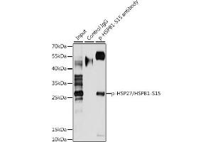 Immunoprecipitation analysis of 200 μg extracts of HeLa cells, using 3 μg Phospho-HSP27/HSPB1-S15 pAb . (HSP27 anticorps  (pSer15))