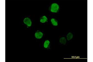 Immunofluorescence of purified MaxPab antibody to IHPK2 on HeLa cell.
