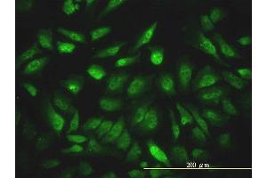 Immunofluorescence of monoclonal antibody to NCOA4 on HeLa cell.