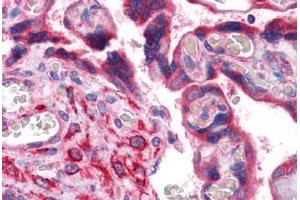 Human Placenta: Formalin-Fixed, Paraffin-Embedded (FFPE)