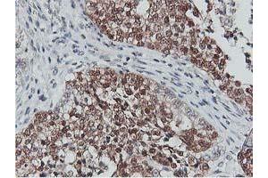 Image no. 5 for anti-CoA Synthase (COASY) antibody (ABIN1497556) (COASY anticorps)