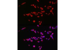 Immunofluorescence analysis of SH-SY5Y cells using GRIN2B Rabbit pAb (ABIN3017275, ABIN3017276, ABIN3017277 and ABIN1680110) at dilution of 1:100 (40x lens). (GRIN2B anticorps  (C-Term))