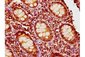 IHC image of ABIN7163299 diluted at 1:400 and staining in paraffin-embedded human appendix tissue performed on a Leica BondTM system.