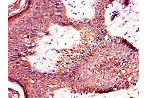 Immunohistochemistry of paraffin-embedded human skin tissue using ABIN7172328 at dilution of 1:100 (TANK anticorps  (AA 4-98))