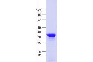 Validation with Western Blot