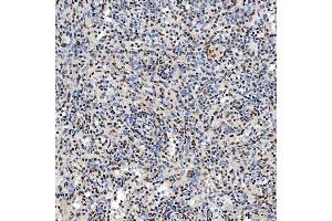 IHC analysis of SNRNP40 using anti-SNRNP40 antibody (ABIN7601719). (SNRNP40 anticorps  (AA 43-357))