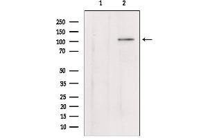 Western blot analysis of extracts from mouse lung, using Klotho Antibody. (Klotho anticorps)