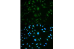 Immunofluorescence analysis of MCF7 cell using IL23R antibody. (IL23R anticorps  (AA 405-629))