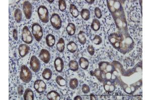 anti-Zinc Finger Protein 259 (znf259) (AA 361-459) antibody