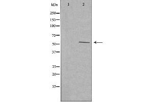 Western blot analysis of extracts from HeLa cells using Cytochrome P450 2W1 antibody. (CYP2W1 anticorps  (Internal Region))