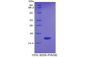 SDS-PAGE (SDS) image for Sema Domain, Immunoglobulin Domain (Ig), Transmembrane Domain (TM) and Short Cytoplasmic Domain, (Semaphorin) 4D (SEMA4D) (AA 502-636) protein (His tag) (ABIN1980938) (SEMA4D/CD100 Protein (AA 502-636) (His tag))