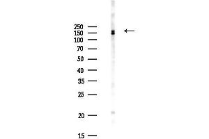 Western blot analysis of lysates from Hela cells(UV,30 min treatment), using PREX2 Antibody at 1/1000 dilution.