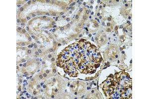Immunohistochemistry of paraffin-embedded Rat kidney using CETP Polyclonal Antibody (CETP anticorps)