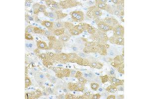 Immunohistochemistry of paraffin-embedded human liver using VEGFB Rabbit pAb (ABIN7271298) at dilution of 1:150 (40x lens).