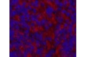 Immunofluorescence analysis of Mouse spleen tissue using MAP1LC3A Monoclonal Antibody at dilution of 1:200.