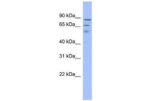 C1orf25 antibody used at 0. (TRMT1L anticorps  (Middle Region))