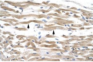 Immunohistochemical staining (Formalin-fixed paraffin-embedded sections) of human muscle with KIFC2 polyclonal antibody . (KIFC2 anticorps  (AA 150-199))