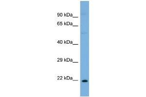 Host:  Rabbit  Target Name:  ST8SIA1  Sample Type:  OVCAR-3 Whole cell lysates  Antibody Dilution:  1. (ST8SIA1 anticorps  (N-Term))