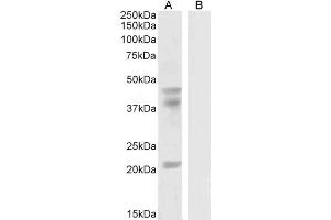 ABIN190778 (0. (GABPB2 anticorps  (Internal Region))