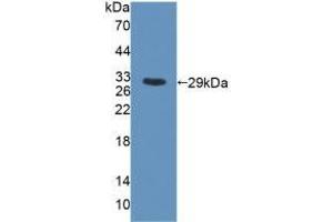 Figure. (MYH6 anticorps  (AA 419-666))