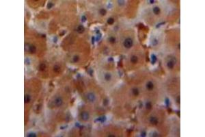 Used in DAB staining on fromalin fixed paraffin-embedded Liver tissue (SAA anticorps  (AA 20-122))