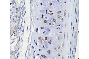Immunohistochemistry of paraffin-embedded Rat trachea using COMP Polyclonal Antibody at dilution of 1:100 (40x lens). (COMP anticorps)
