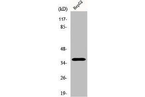 Western Blot analysis of Jurkat cells using Ephrin-A3 Polyclonal Antibody (Ephrin A3 anticorps  (C-Term))