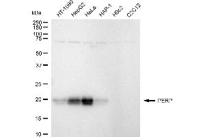 Western blotting analysis using PERP antibody (ABIN7800577). (Recombinant PERP anticorps)