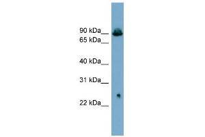 WB Suggested Anti-SLC6A5 Antibody Titration:  0. (SLC6A5 anticorps  (Middle Region))