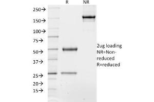 SDS-PAGE Analysis of Purified TCF4 Mouse Monoclonal Antibody (TCF4/1705).