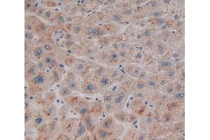 Used in DAB staining on fromalin fixed paraffin- embedded Kidney tissue (RSU1 anticorps  (AA 2-277))