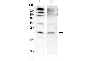 Western blot analysis of KGF using anti-KGF antibody . (FGF7 anticorps  (AA 32-194))