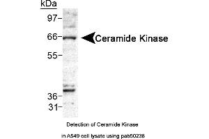 Image no. 1 for anti-Ceramide Kinase (CERK) (AA 50-150) antibody (ABIN363547) (CERK anticorps  (AA 50-150))