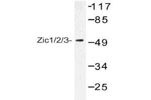 Western blot (WB) analysis of Zic1/2/3 antibody in extracts from Jurkat cells. (ZIC1 anticorps)