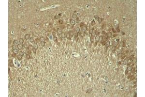 Immunohistochemical analysis of paraffin-embedded rat hippocampal region tissue from a model with Alzheimer