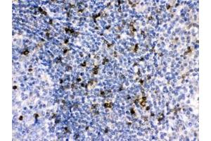 IHC testing of FFPE human tonsil with APOBEC3G antibody at 1ug/ml.