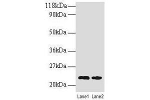 Western blot All lanes: TAGLN antibody at 2 μg/mL Lane 1: EC109 whole cell lysate Lane 2: 293T whole cell lysate Secondary Goat polyclonal to rabbit IgG at 1/15000 dilution Predicted band size: 23 kDa Observed band size: 23 kDa (Transgelin anticorps  (AA 2-201))