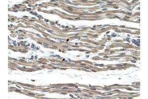 COX15 antibody was used for immunohistochemistry at a concentration of 4-8 ug/ml to stain Skeletal muscle cells (arrows) in Human Muscle. (COX15 anticorps)